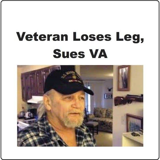 Veteran MRSA Leg