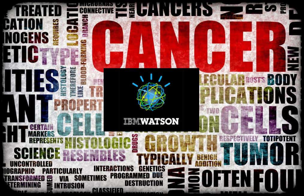 IBM Watson