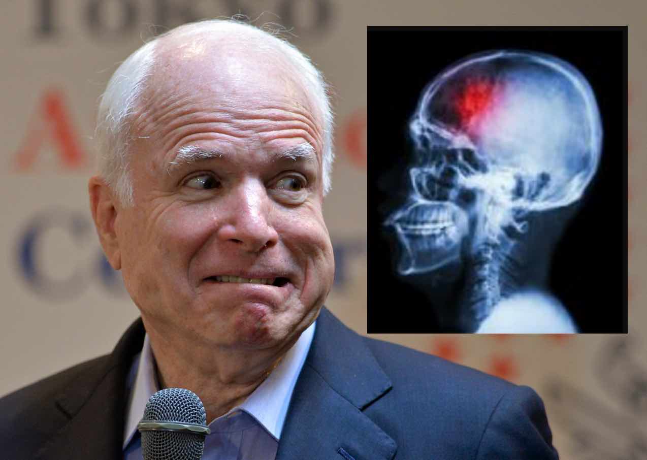John McCain Brian Tumor