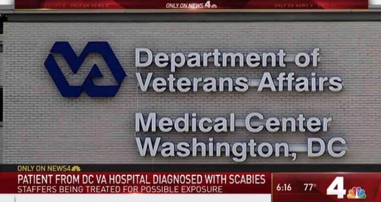More Than A Dozen Impacted By Scabies At VA Medical Center