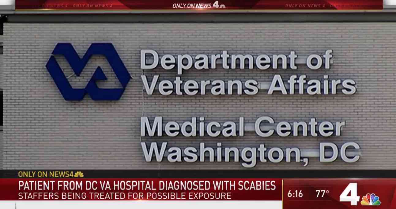 Scabies Washington DC VA